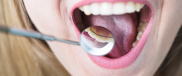 l&aacute;thatatlan fogszab&aacute;lyoz&oacute; kiv&aacute;l&oacute; hat&eacute;konys&aacute;ggal