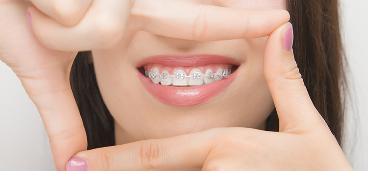 damon fogszab&aacute;lyoz&oacute;