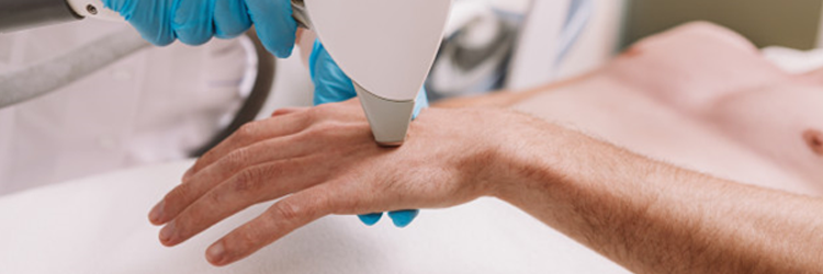 l&eacute;zeres szőrtelen&iacute;t&eacute;s &aacute;r f&aacute;jdalommentes szőrtelen&iacute;t&eacute;shez