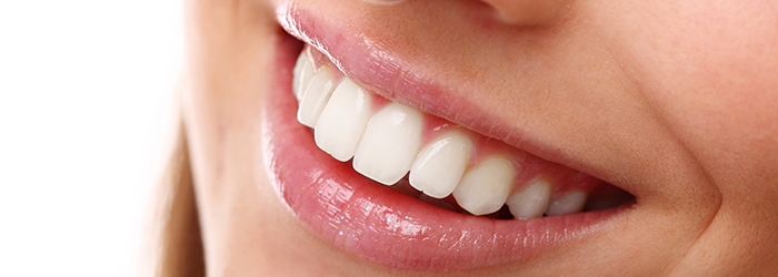 mosolytervez&eacute;s &aacute;rak