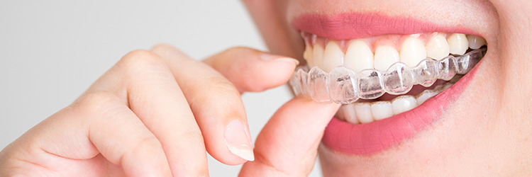 l&aacute;thatatlan fogszab&aacute;lyoz&oacute; k&ouml;nnyű tiszt&iacute;t&aacute;ssal