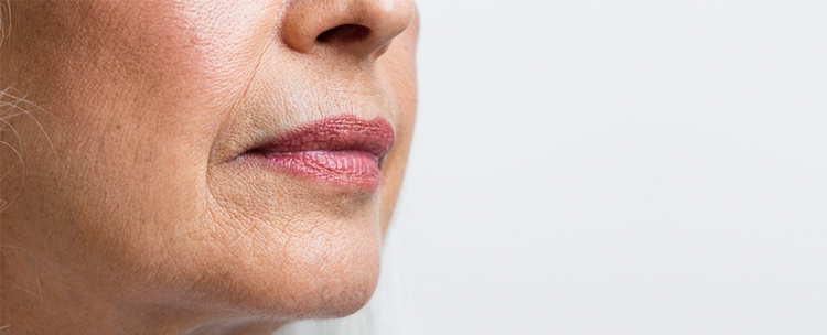 mikrodermabr&aacute;zi&oacute; a mimikai r&aacute;ncok ellen