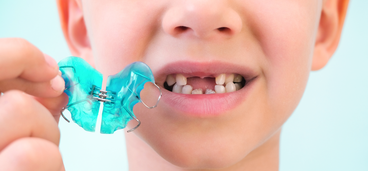 gyermek fogszab&aacute;lyoz&aacute;s sor&aacute;n vid&aacute;m sz&iacute;neket &eacute;s mint&aacute;kat haszn&aacute;lunk