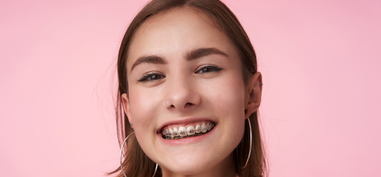 tin&eacute;dzsereknek is sz&oacute;l a gyermek fogszab&aacute;lyoz&aacute;s