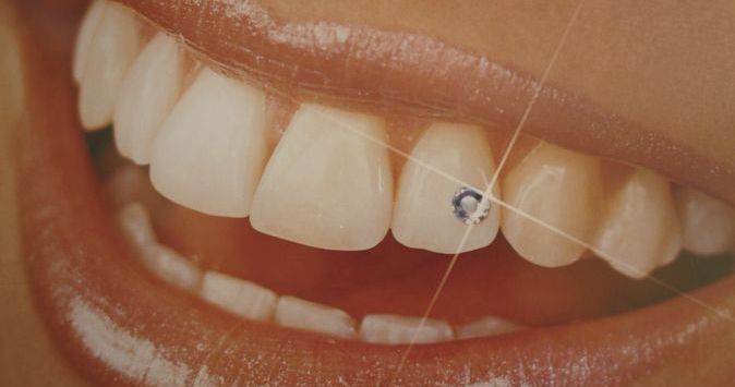 A mosoly a legelőnyösebb ékszer