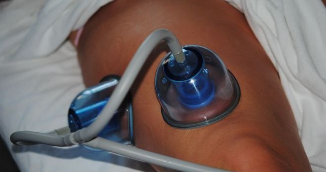 Otthoni ápolás kezelés után 15.