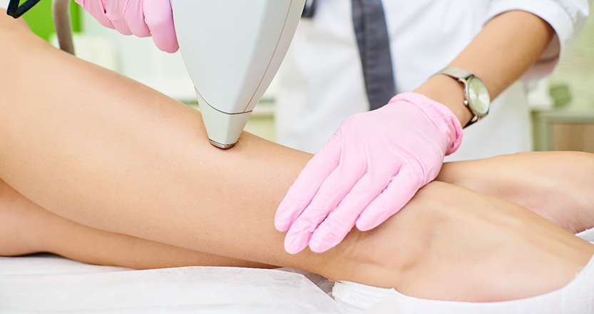 Lézeres szőrtelenítés ára