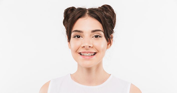 Mitől olyan forradalmi a Damon Clear fogszabályozó?