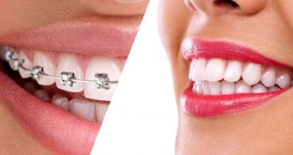 Amikor akasztják a hóhért...3.rész