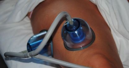 Otthoni ápolás kezelés után 15.