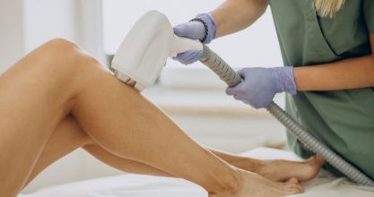 Mire érdemes figyelni lézeres szőrtelenítés után?